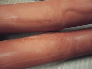 Case 5: 
